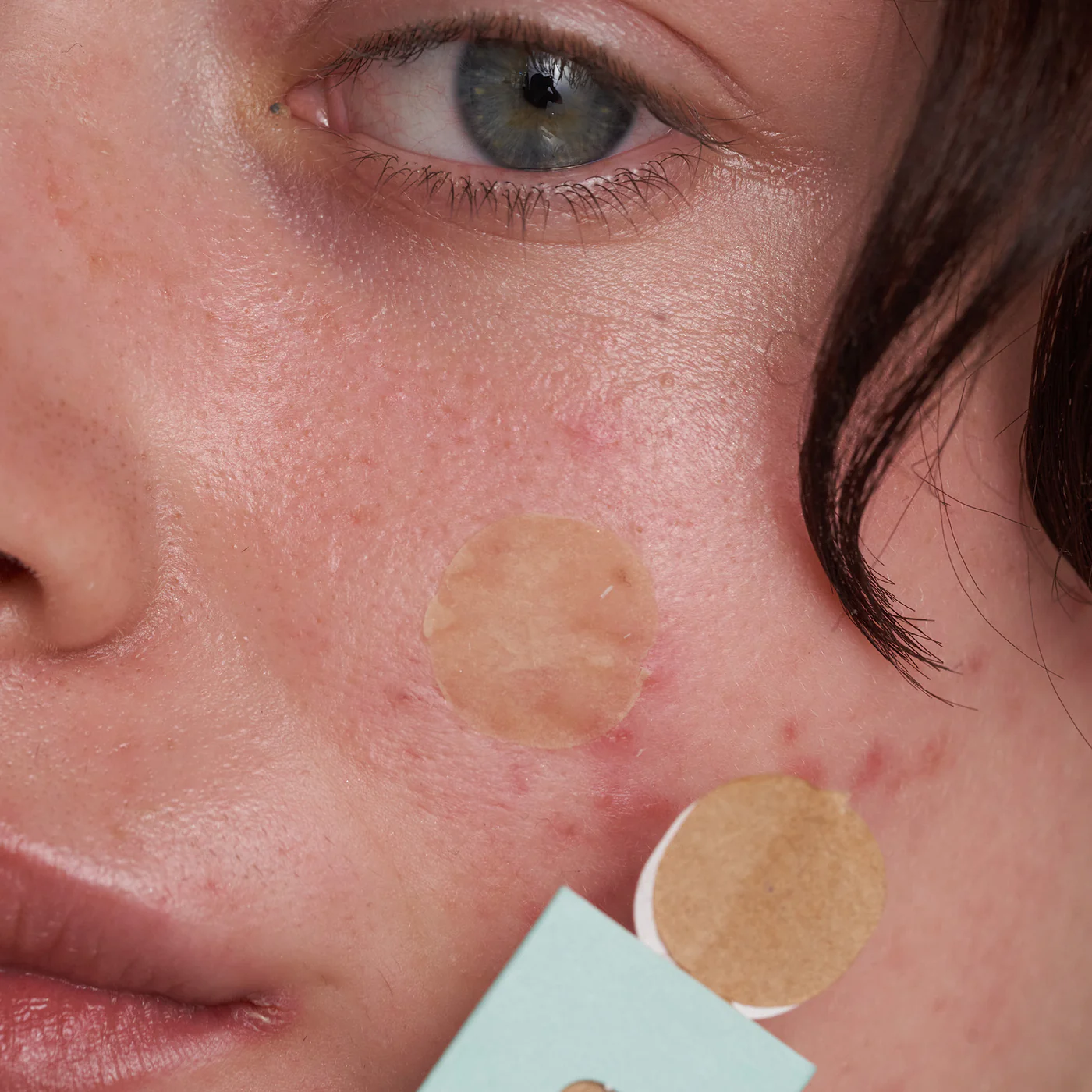 Blemish-Fighting Spot Dots image 3